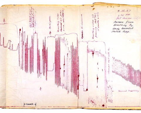 This is a leaf from Philip Drinker’s laboratory notebook chronicling his research with Louis Agassiz Shaw in artificial respiration.